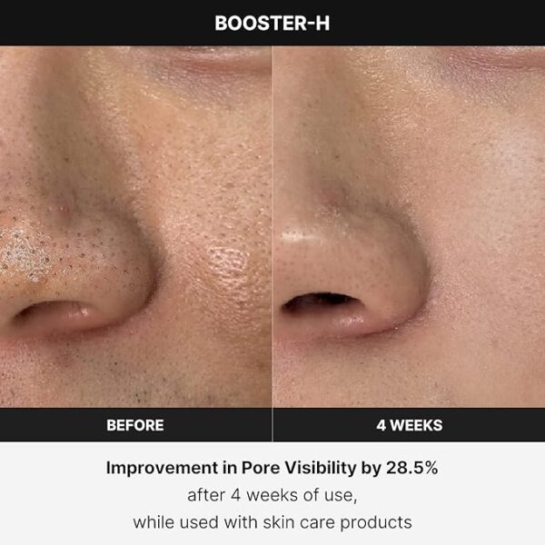 Medicube Age-R Booster H - Korean No.1 Skin Care Device - Image 2